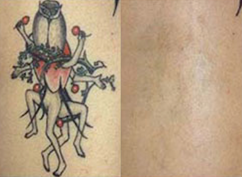 Tattoo before and after
